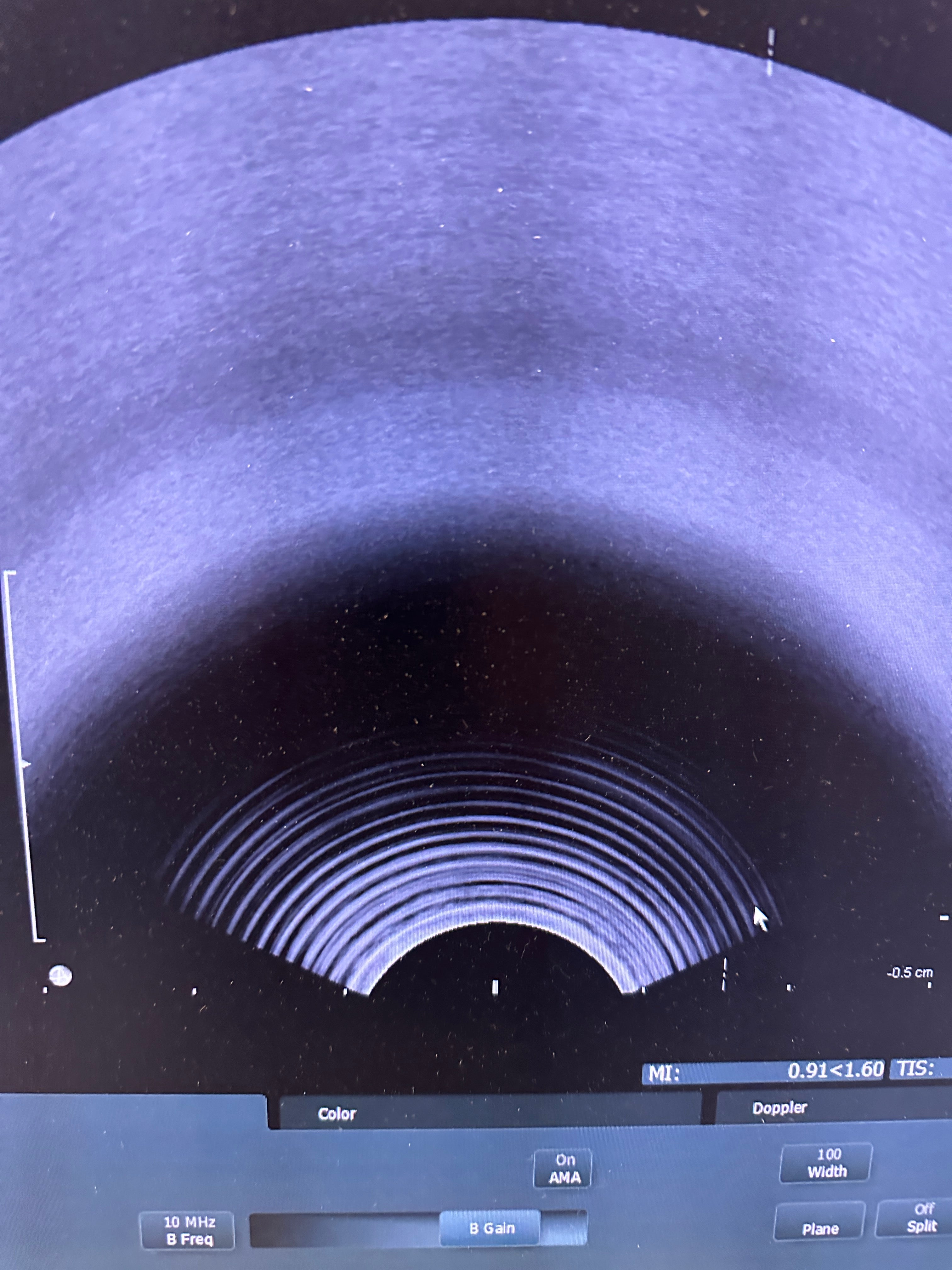 BK Medical Ultrasound Probe BK 8808e Endo Vaginal Transducer TV probe - DIAGNOSTIC ULTRASOUND MACHINES FOR SALE