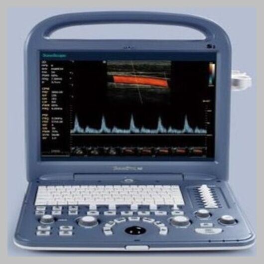 SonoScape S2 with one Linear array Probe L741 5.0-10.0 Mhz DIAGNOSTIC ULTRASOUND MACHINES FOR SALE