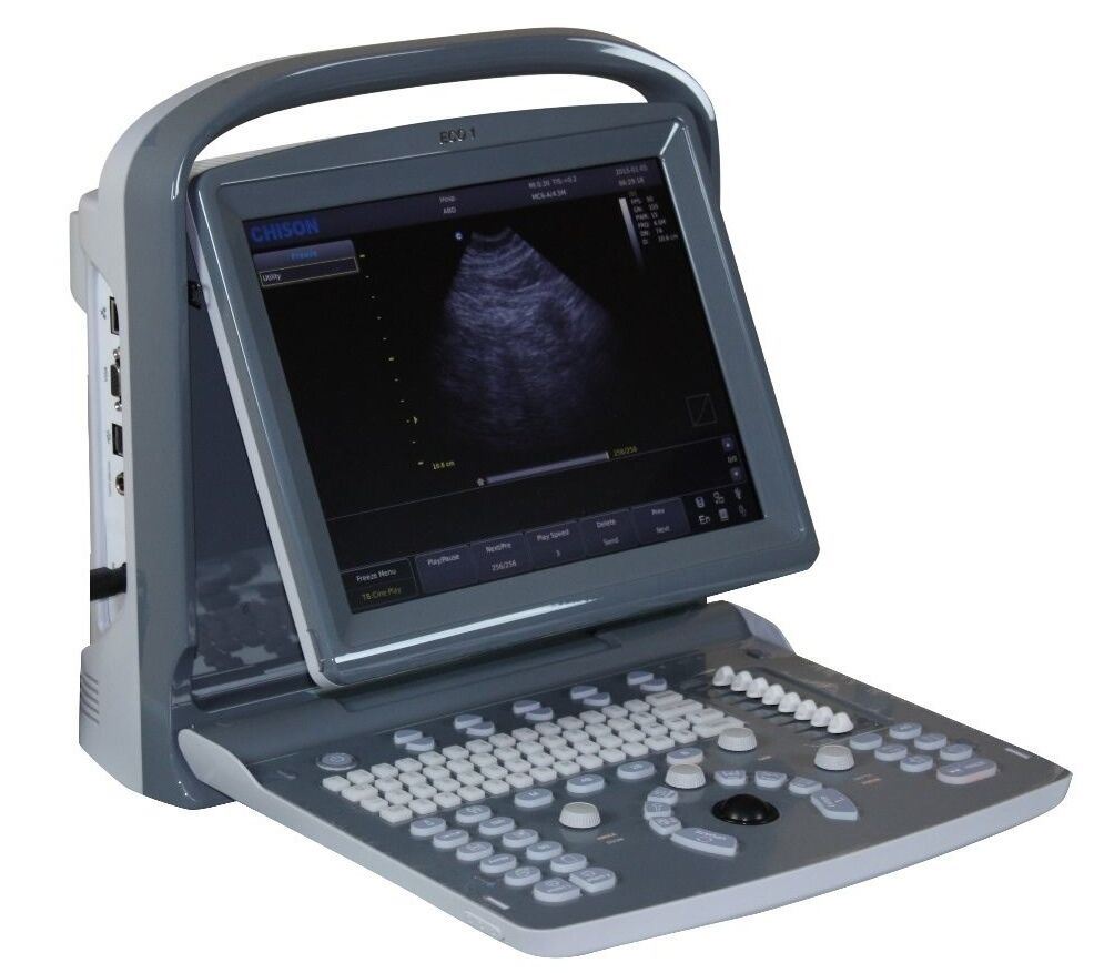 Chison ECO1 Portable LED Ultrasound Scanner two probes Convex & linear array DIAGNOSTIC ULTRASOUND MACHINES FOR SALE