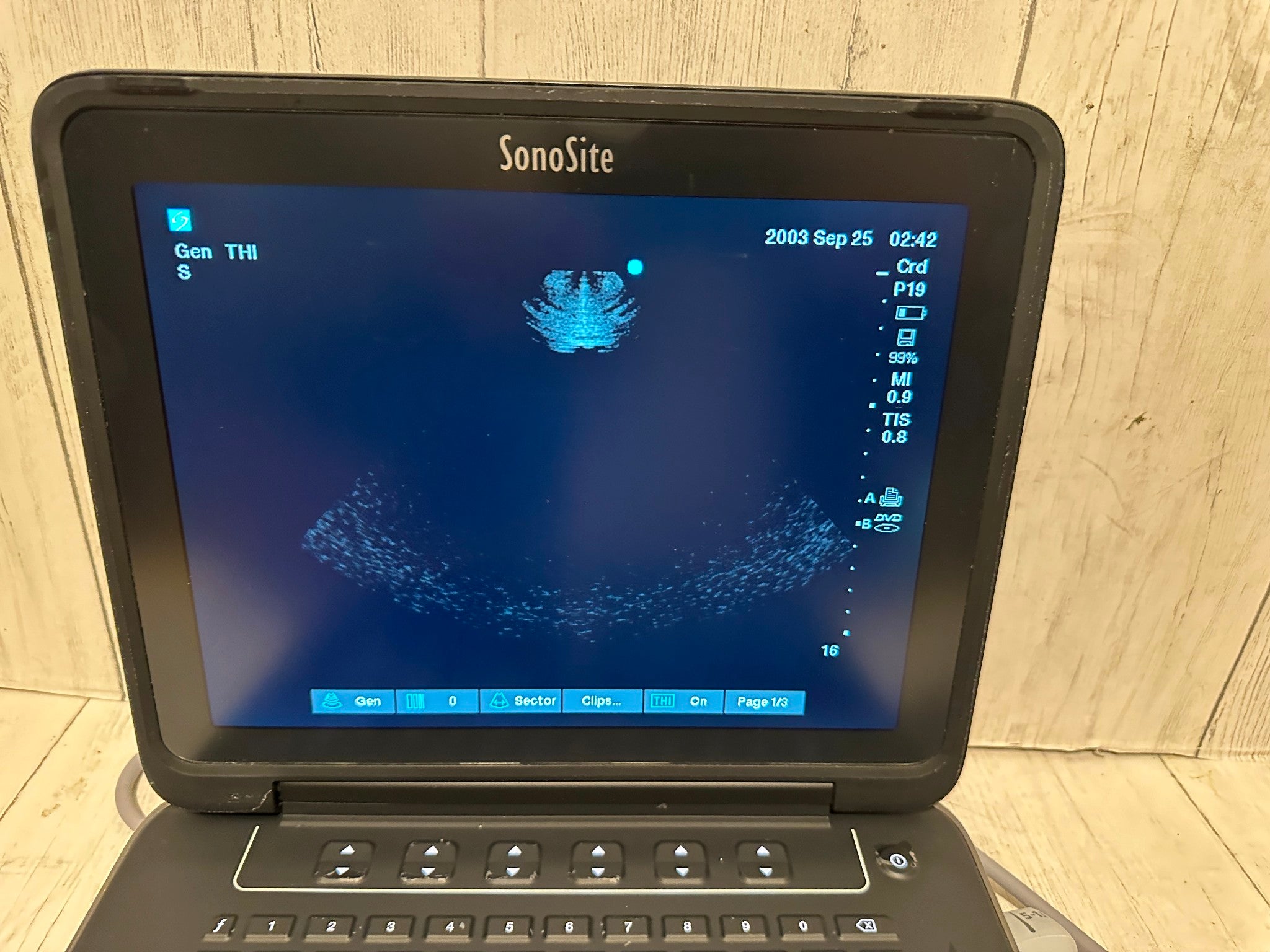 Sonosite Edge II Ultrasound 2016, DICOM with Phased Array probe rP19x DIAGNOSTIC ULTRASOUND MACHINES FOR SALE