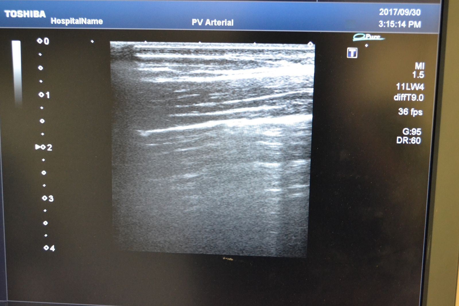 Toshiba Artida PLT-704SBT 11-4.8MHz Linear Ultrasound Transducer Probe J1624 DIAGNOSTIC ULTRASOUND MACHINES FOR SALE