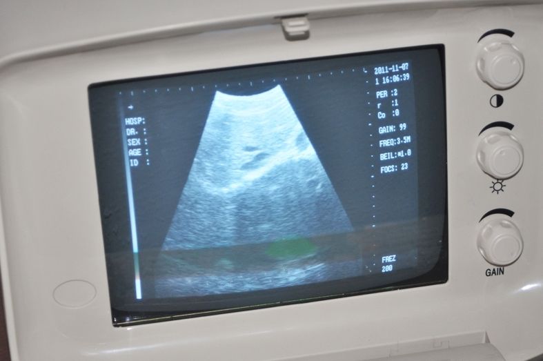 Digital Ultrasound Scanner B Ultrasound machine Convex +Linear 2 Probes 3D Sale DIAGNOSTIC ULTRASOUND MACHINES FOR SALE