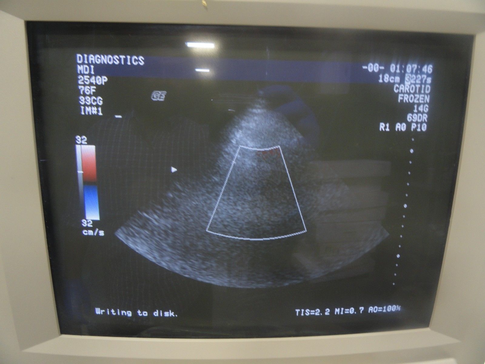 GE 227s P/N 2118743 Phased Array 2-4 MHz Probe W/ Hook for GE Logiq 700 (5979 DIAGNOSTIC ULTRASOUND MACHINES FOR SALE