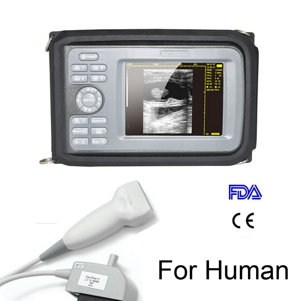 Handheld Ultrasound Scanner Digital Machine w Linear Probe Free Box & Battery 190891515230 DIAGNOSTIC ULTRASOUND MACHINES FOR SALE