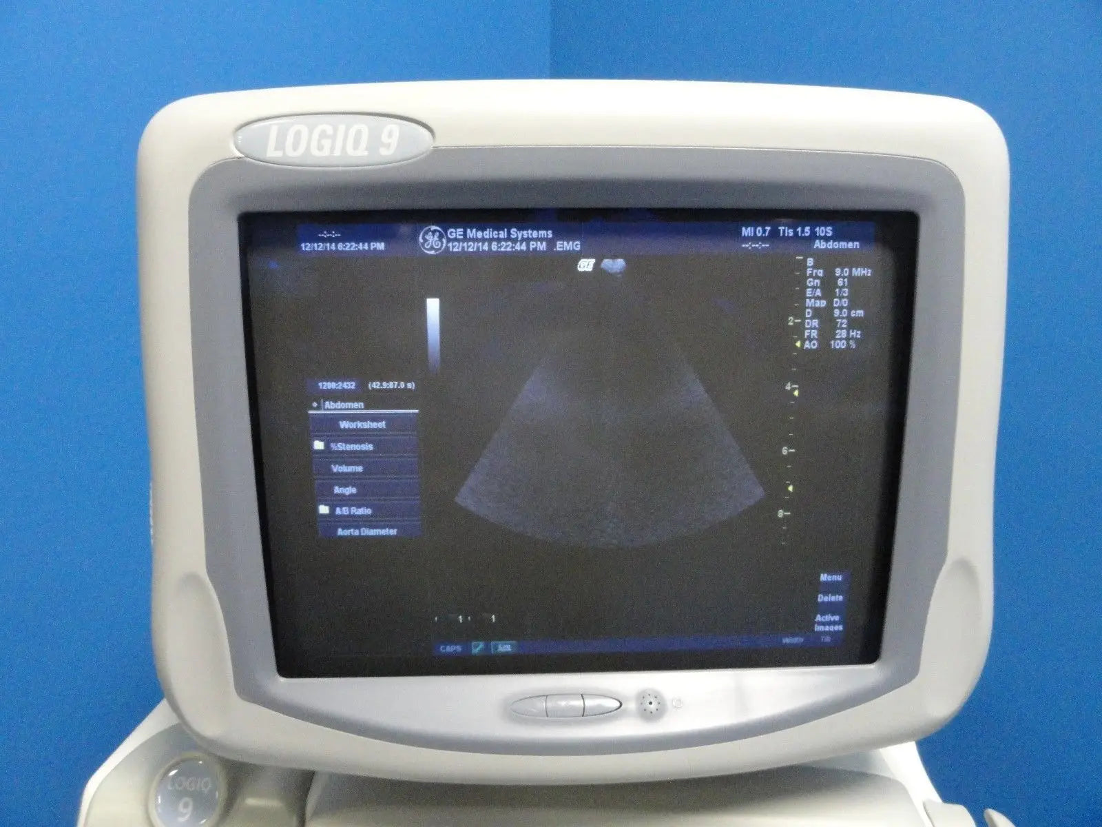 GE 10S Sector Ultrasound Transducer for GE Logiq 7, 9, S6 & Vivid Series (8390) DIAGNOSTIC ULTRASOUND MACHINES FOR SALE
