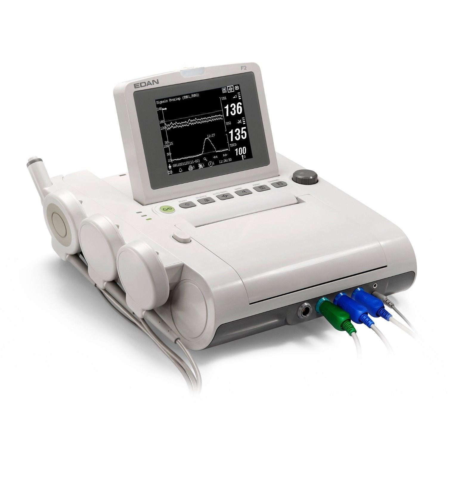 NEW ! EDAN F2 5.6" LCD Display Twin Fetal Heart Rate Monitor / FHR Monitor DIAGNOSTIC ULTRASOUND MACHINES FOR SALE