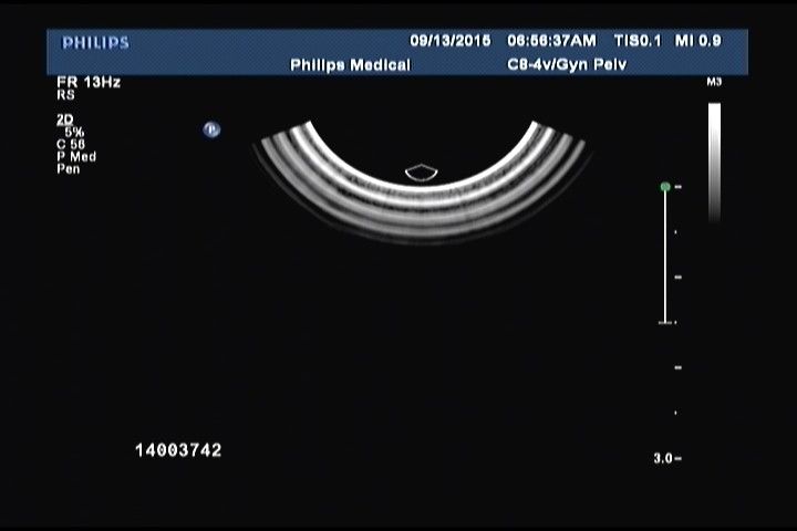 ultrasound image