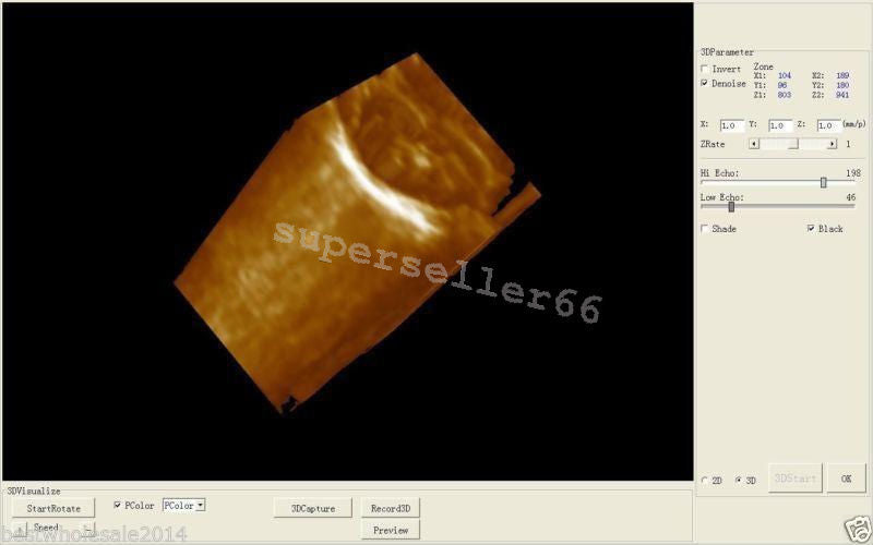 LCD Digital 10.1 Inch Ultrasound Scanner + Convex ,Transvaginal Probe ,Battery DIAGNOSTIC ULTRASOUND MACHINES FOR SALE