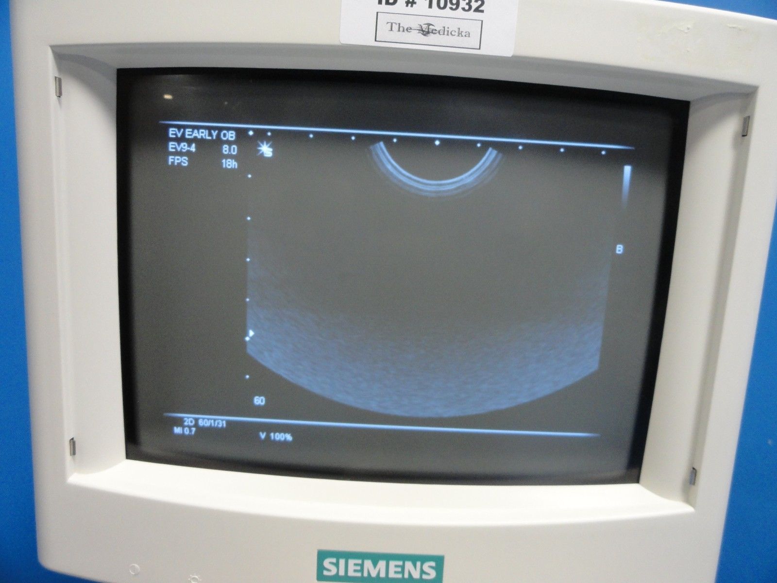 2004 Siemens C5-2 Convex Array Ultrasound Transducer for Sonoline G20 (11452) DIAGNOSTIC ULTRASOUND MACHINES FOR SALE