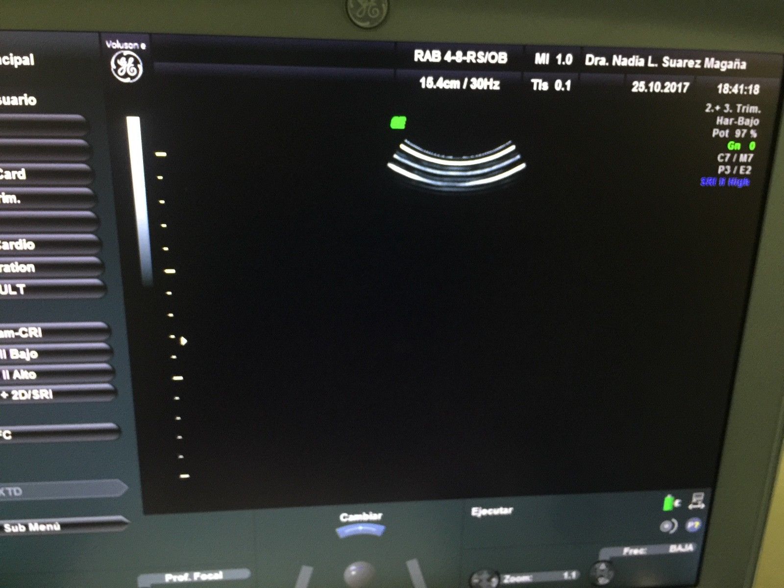 GE RAB4-8-RS 4D CONVEX PROBE FOR VOLUSON i/e/S6/S8 DIAGNOSTIC ULTRASOUND MACHINES FOR SALE