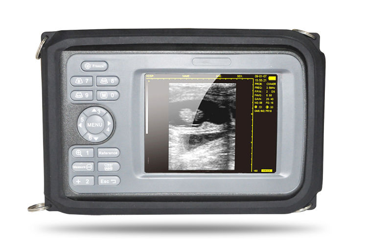 Medical Handheld Digital Ultrasound Scanner Machine Linear Probe+ US PR Oximeter 190891041111 DIAGNOSTIC ULTRASOUND MACHINES FOR SALE