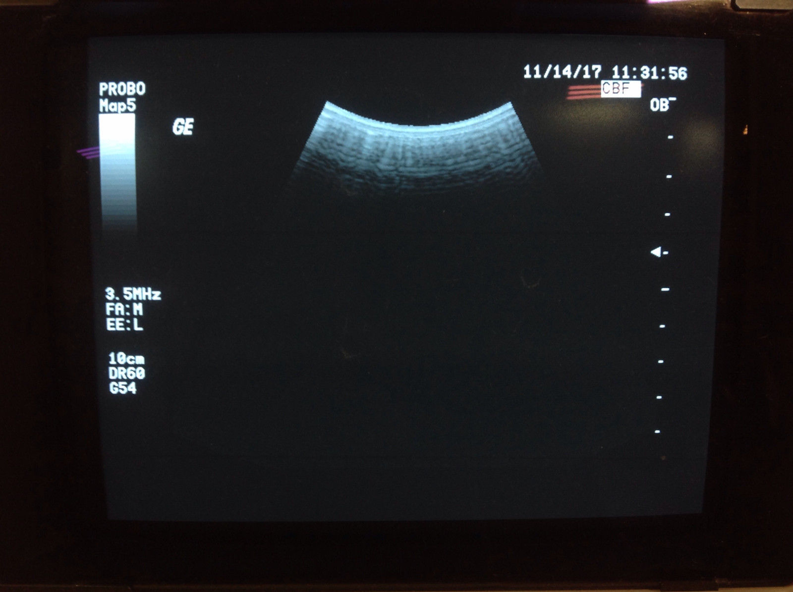 GE CBF 3.5 Ultrasound Probe DIAGNOSTIC ULTRASOUND MACHINES FOR SALE