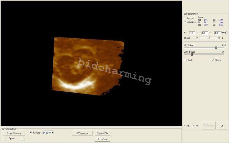 sale Portable Ultrasound Scanner machine Convex + micro-convex probe +3D version 190891736482 DIAGNOSTIC ULTRASOUND MACHINES FOR SALE