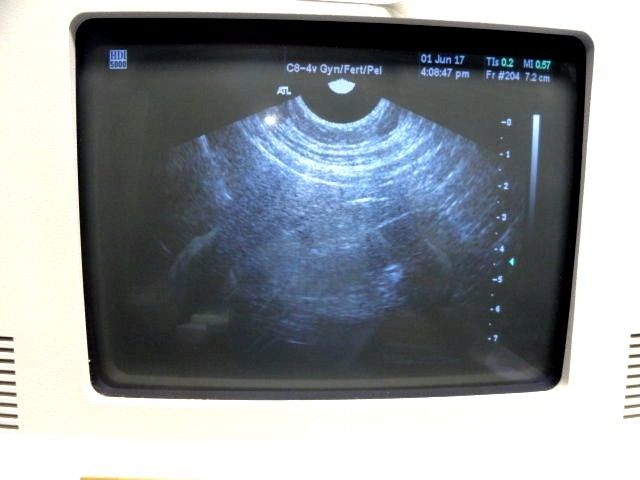 ATL C8-4V IVT Ultrasound Transducer Probe for ATL HDI Series Systems ~ 12848 DIAGNOSTIC ULTRASOUND MACHINES FOR SALE