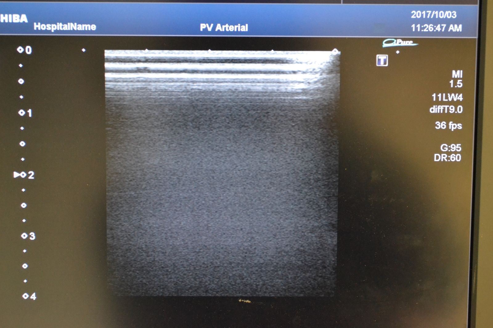 Toshiba Artida PLT-704SBT 11-4.8MHz Linear Ultrasound Transducer Probe J1627 DIAGNOSTIC ULTRASOUND MACHINES FOR SALE