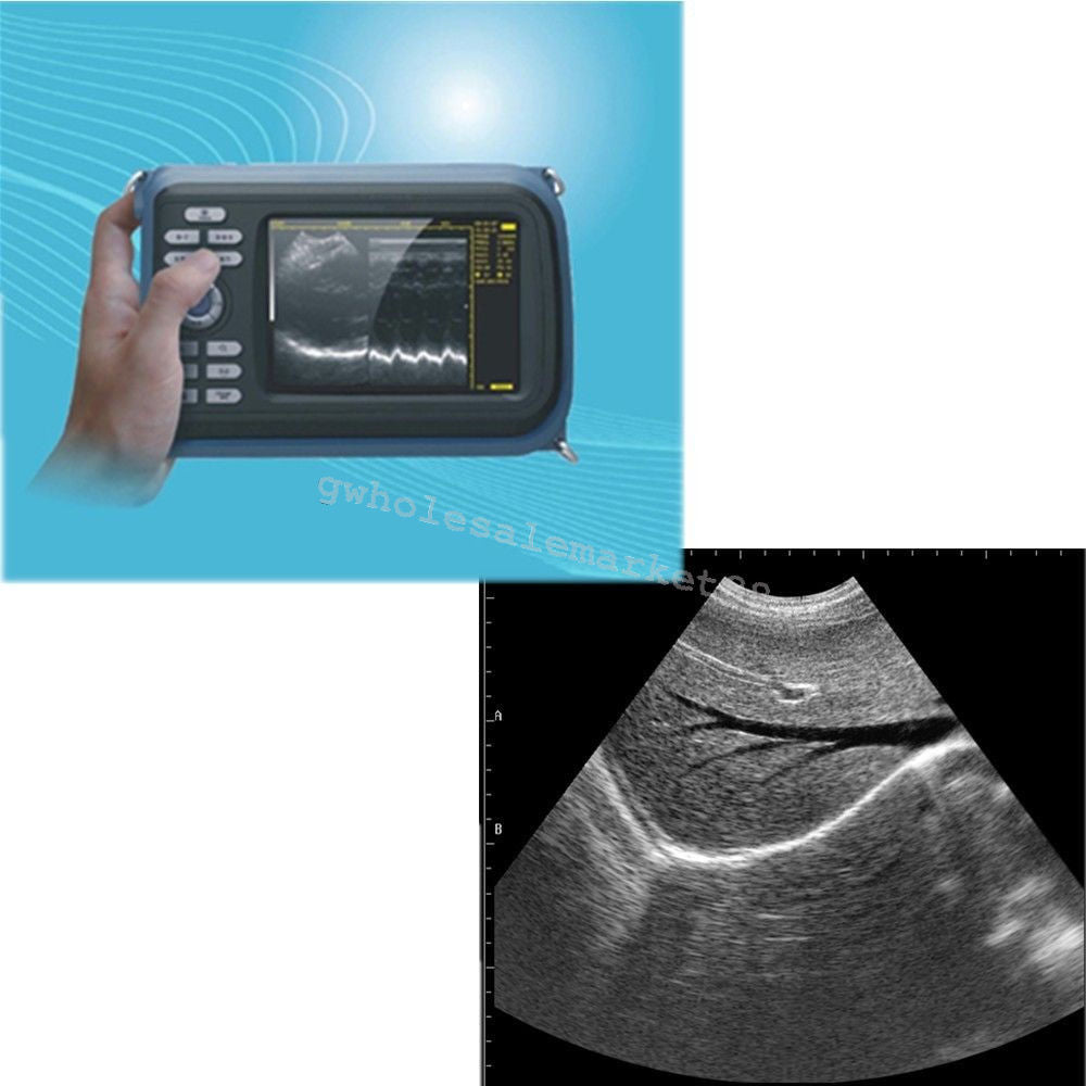 HandScan Full Digital Ultrasound scanner Machine Convex+ Transvaginal probe Case DIAGNOSTIC ULTRASOUND MACHINES FOR SALE
