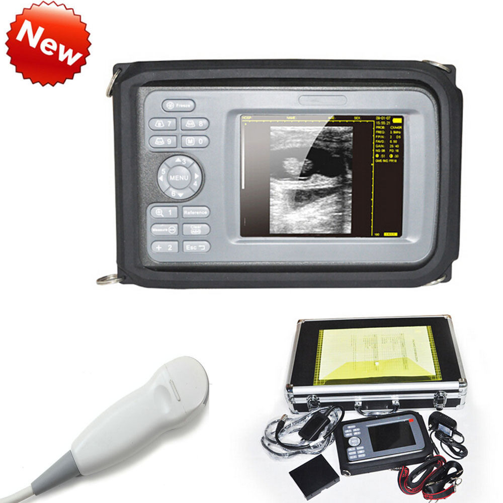 5.5 " Handheld Ultrasound Scanner/Machine Digital Micro-convex Probe Human CE DIAGNOSTIC ULTRASOUND MACHINES FOR SALE