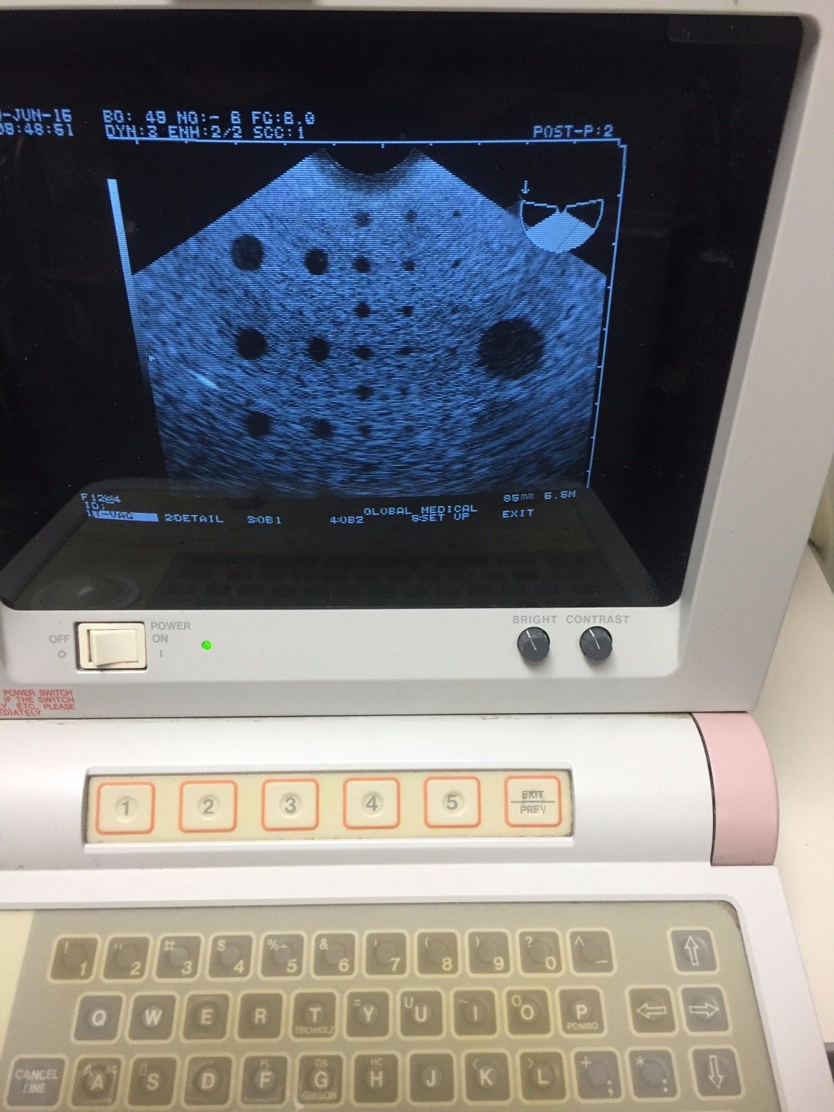 Hitachi EUB-405 Plus Ultrasound / 2 probes / 2 transducer port / printer DIAGNOSTIC ULTRASOUND MACHINES FOR SALE
