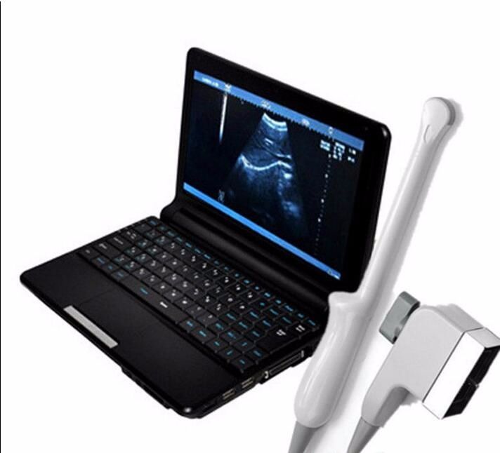 Full Digital Laptop Ultrasound Scanner Probe 6.0mhz Transvaginal Probe 3D Kit 190891462466 DIAGNOSTIC ULTRASOUND MACHINES FOR SALE