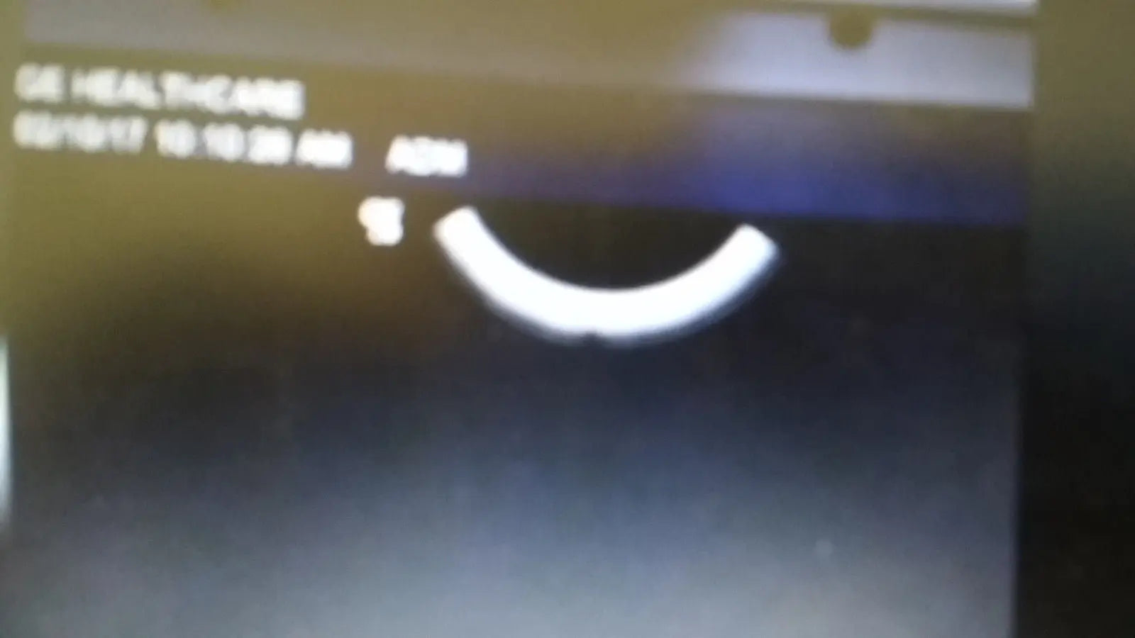 GE E8C-RS ultrasound transducer probe DIAGNOSTIC ULTRASOUND MACHINES FOR SALE