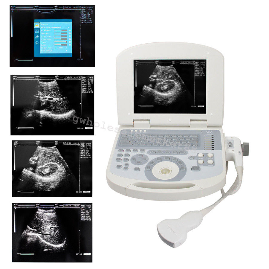 Portable Ultrasound Machine Scanner System Convex probe 3D Software Image Photo 190891045898 DIAGNOSTIC ULTRASOUND MACHINES FOR SALE
