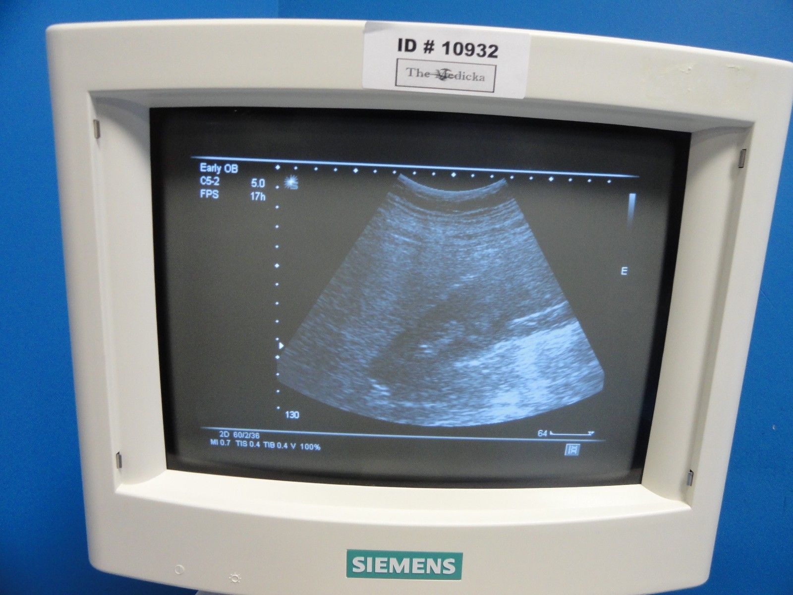 2004 Siemens C5-2 Convex Array Ultrasound Transducer for Sonoline G20 (11452) DIAGNOSTIC ULTRASOUND MACHINES FOR SALE