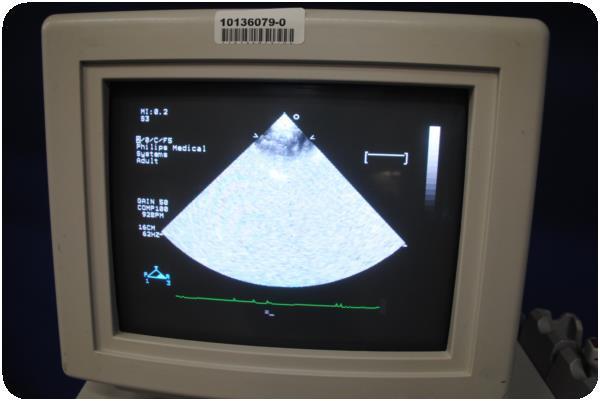 ultrasound monitor