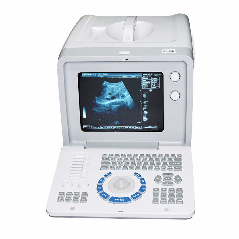 Medical B Ultrasound Ultrasound Scanner Machine + Linear Probe/Sensor + 3D A+ 190891833112 DIAGNOSTIC ULTRASOUND MACHINES FOR SALE