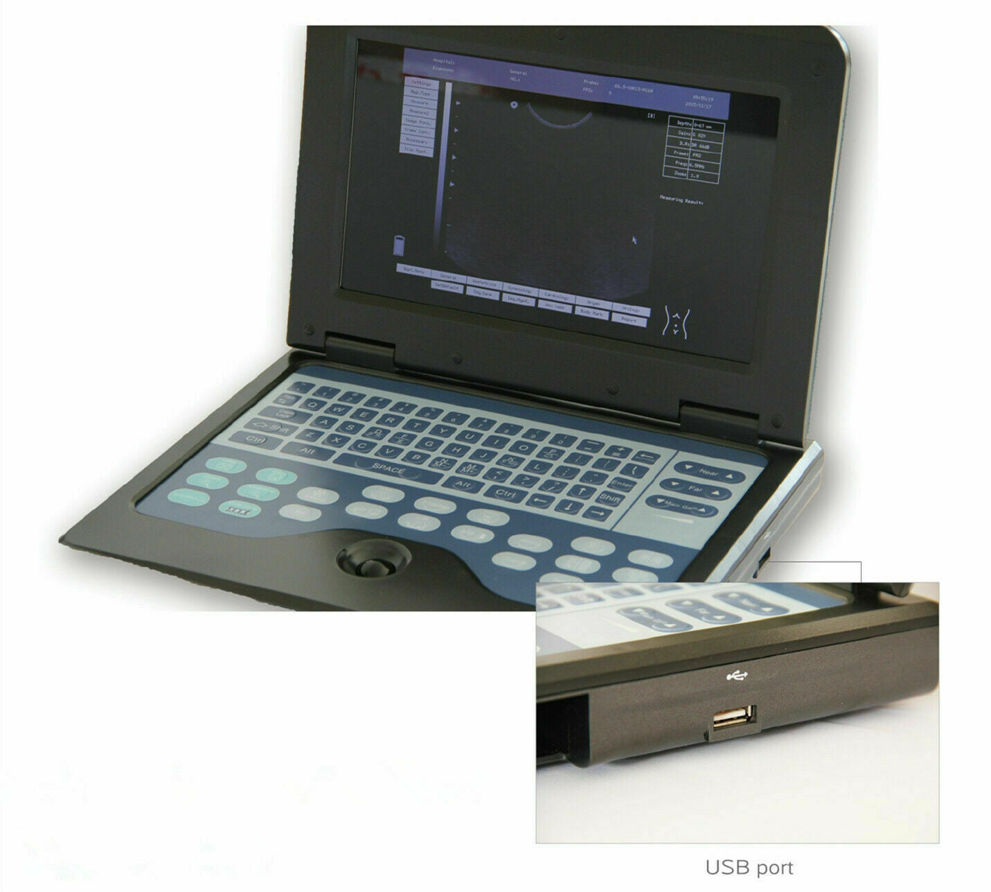 Digital Portable Ultrasound Machine Laptop Scanner with 3.5Mhz Convex Probe CE 6945040100362 DIAGNOSTIC ULTRASOUND MACHINES FOR SALE
