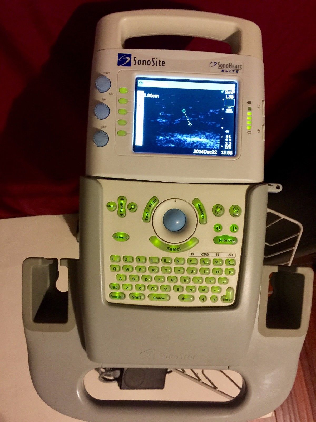 SONOSITE Ultrasound Sonoheart Elite With Cart DIAGNOSTIC ULTRASOUND MACHINES FOR SALE
