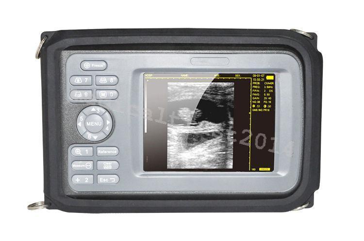 Mini Portable Color LCD Digital Ultrasound Scanner Monitor Convex Linear Probes 190891556233 DIAGNOSTIC ULTRASOUND MACHINES FOR SALE