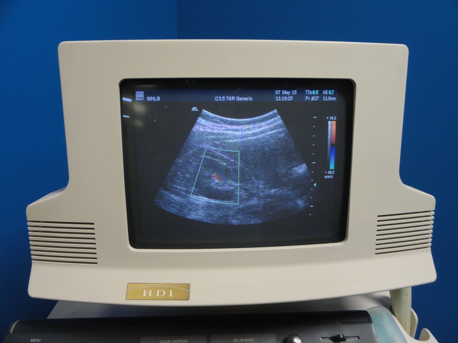 Philips ATL C3.5 76R Convex / Curved Array Ultrasound Transducer Probe (8837) DIAGNOSTIC ULTRASOUND MACHINES FOR SALE