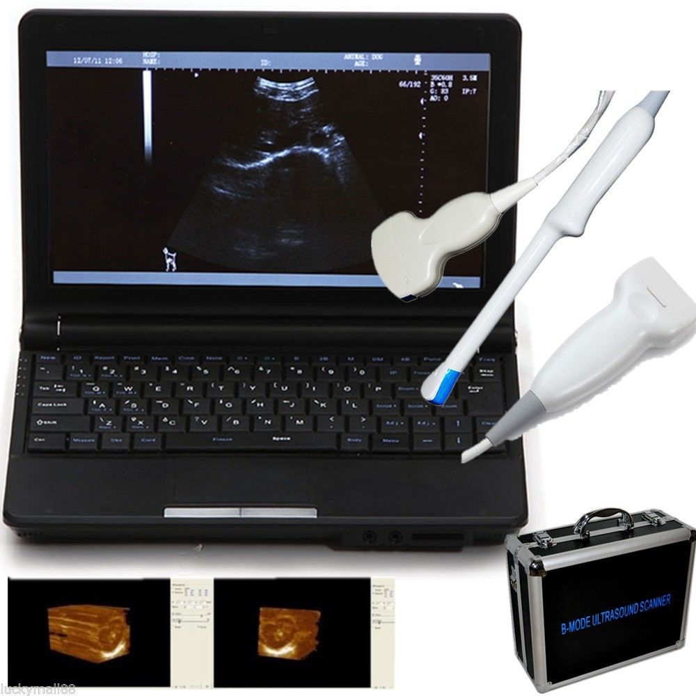 Hospital Laptop Machine Ultrasound Scanner Convex/Linear/Endovaginal Probe +Case 190891044686 DIAGNOSTIC ULTRASOUND MACHINES FOR SALE