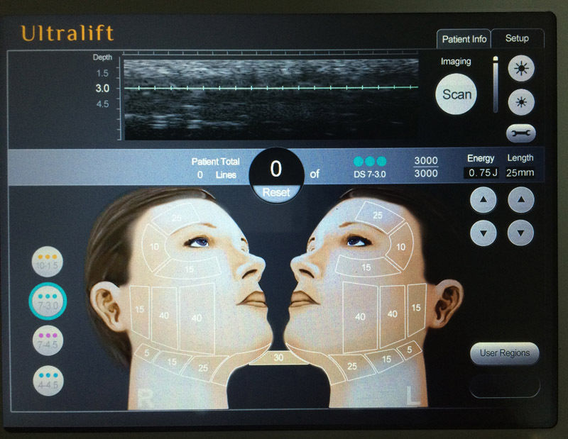 High Intensity Focused Ultrasound HIFU RF Wrinkle Removal Anti-Aging Machine 601393982494 DIAGNOSTIC ULTRASOUND MACHINES FOR SALE