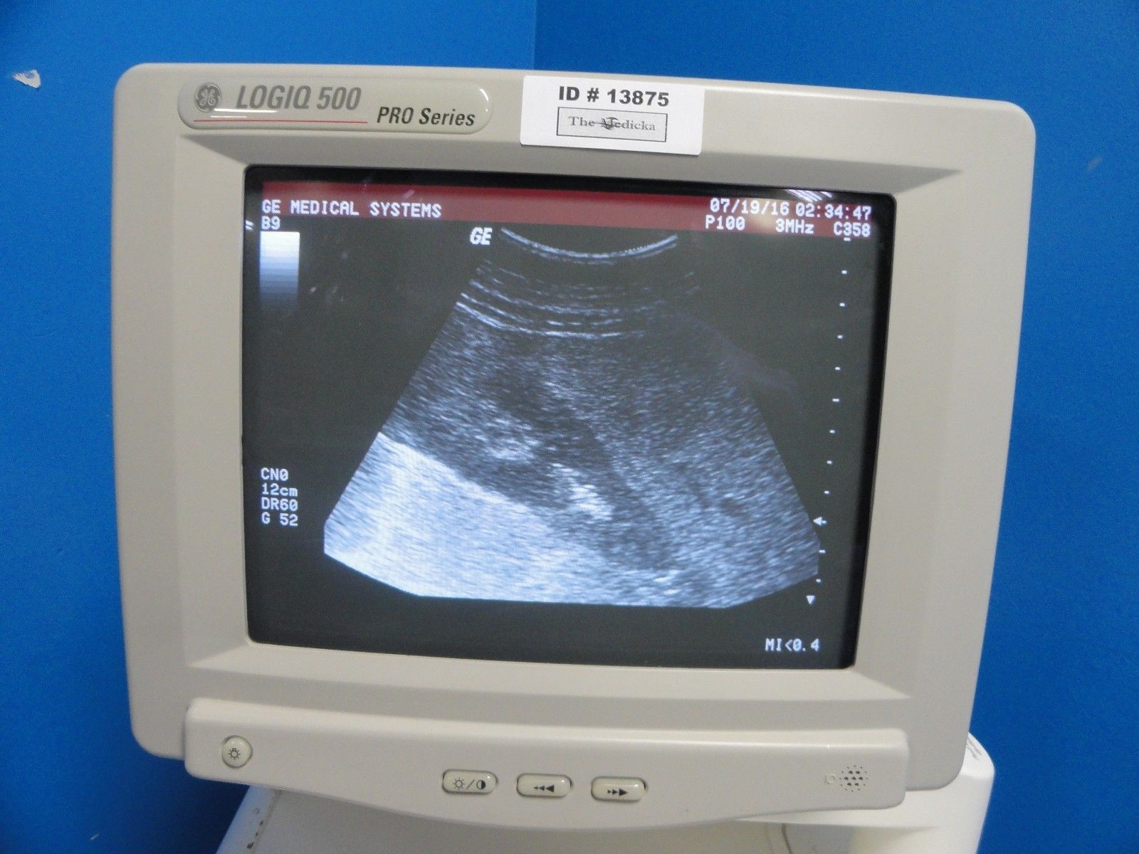 GE C358 Model # 2259151 Convex Probe for GE Logiq 400 & 500, Vivid 3 & 4 ~13876 DIAGNOSTIC ULTRASOUND MACHINES FOR SALE