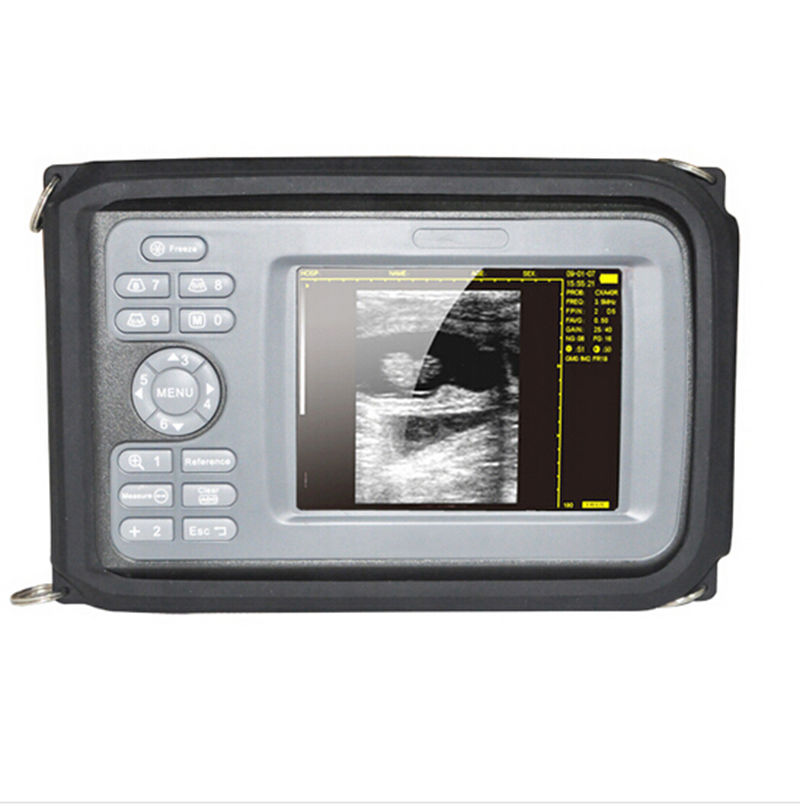 5.5 " Handheld Ultrasound Scanner/Machine Digital Micro-convex Probe Human CE DIAGNOSTIC ULTRASOUND MACHINES FOR SALE