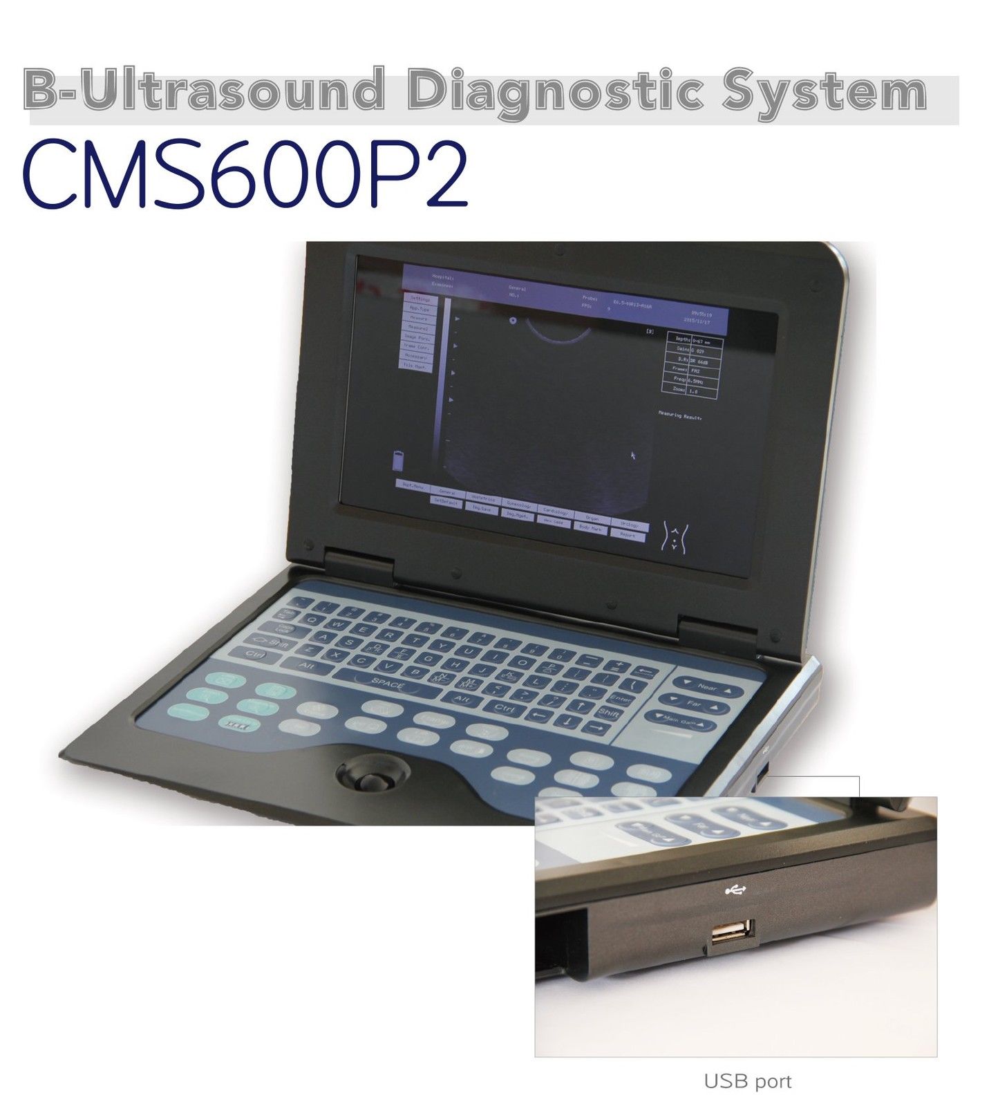 Digital Portable Laptop Ultrasound Scanner Machine 7.5M Linear Probe 600P2 CE 658126923446 DIAGNOSTIC ULTRASOUND MACHINES FOR SALE