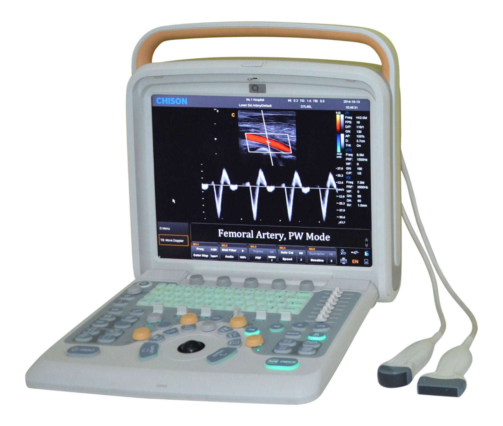 Color Doppler Ultrasound Chison Q5 with Trolley, and Linear Array Probe 5-10Mhz DIAGNOSTIC ULTRASOUND MACHINES FOR SALE