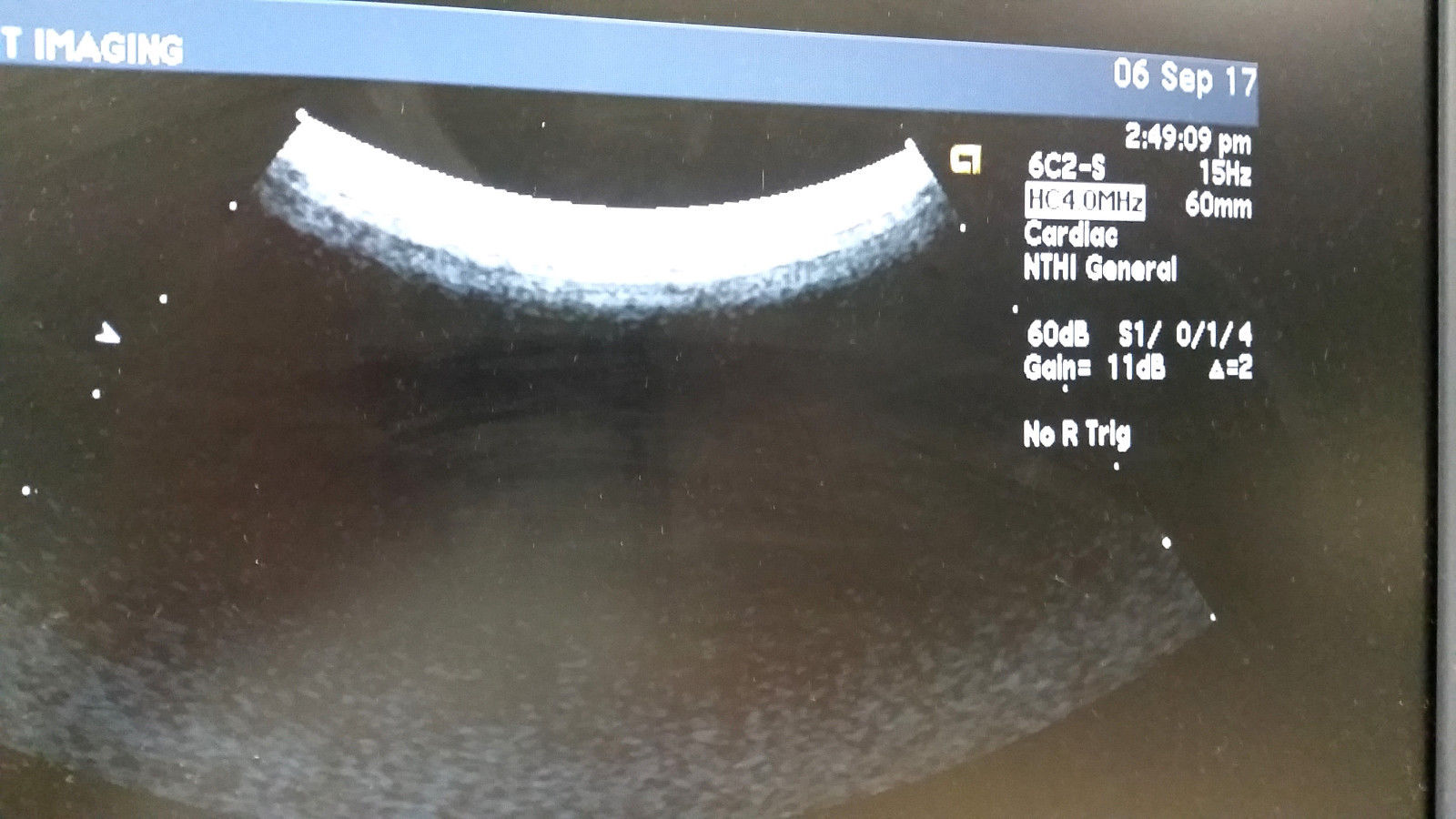 Acuson 6C2 Convex Ultrasound Transducer Probe 08248186 Sequoia 512, S1000 S2000 DIAGNOSTIC ULTRASOUND MACHINES FOR SALE