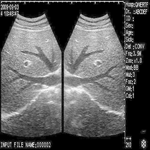 LCD 10'' Free 3D Version Ultrasound Scanner 3.5 Convex +7.5 Transvaginal Probe DIAGNOSTIC ULTRASOUND MACHINES FOR SALE