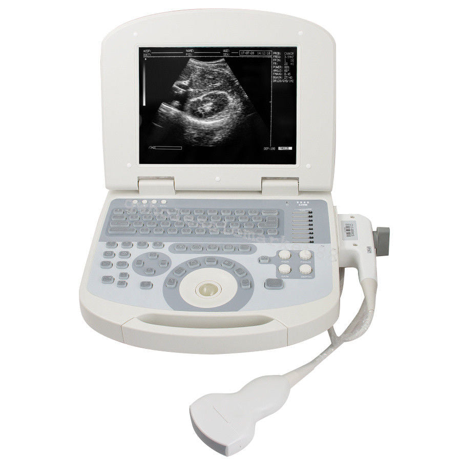 Laptop Ultrasound Machine Scanner Convex Probe 3D Software High Resolution Clear 190891045898 DIAGNOSTIC ULTRASOUND MACHINES FOR SALE