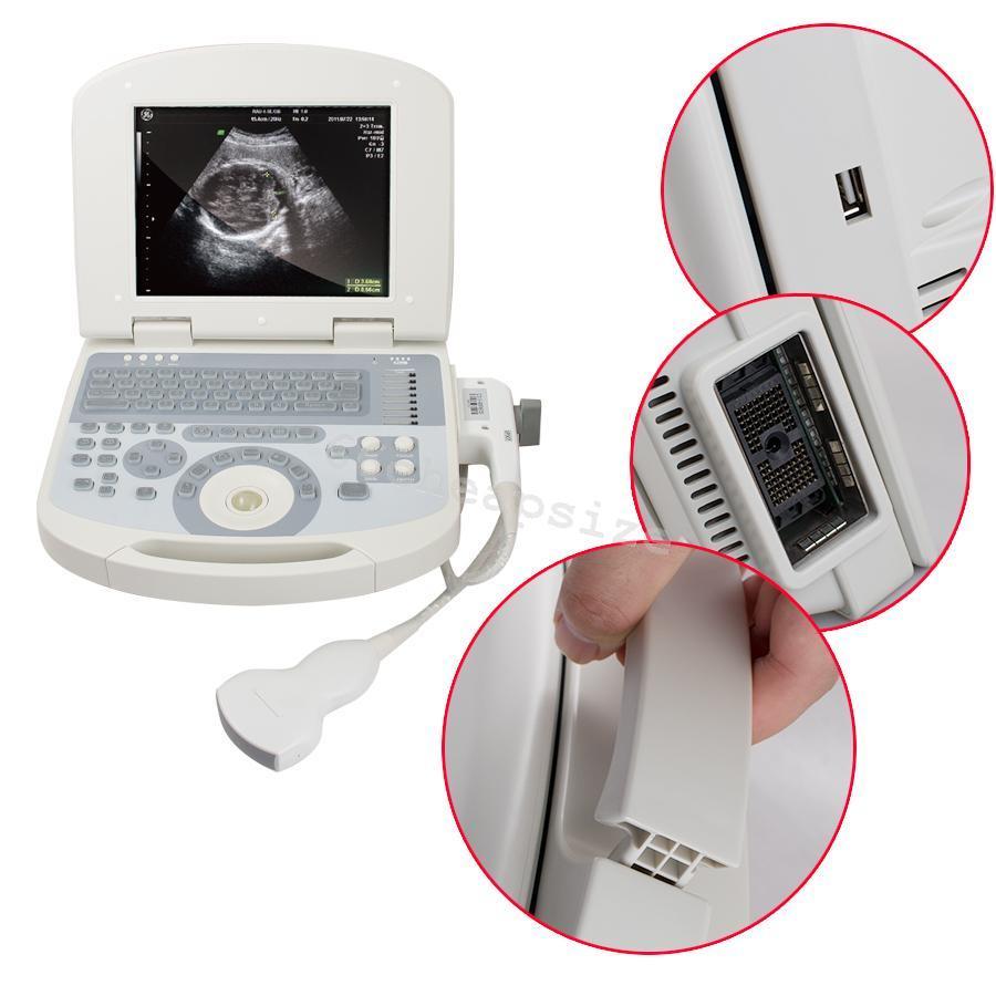 New Digital Laptop Ultrasound Scanner+3.5 MHZ Convex Probe with 3D for Clinic DIAGNOSTIC ULTRASOUND MACHINES FOR SALE