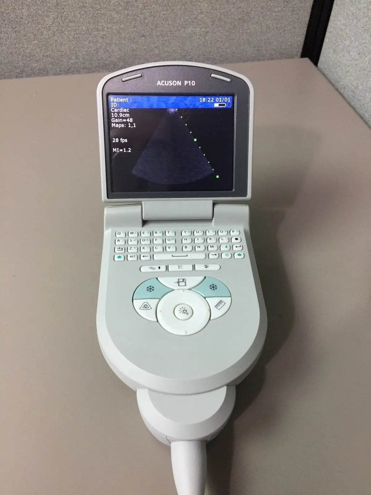 SIEMENS ACUSON P10 PORTABLE ULTRASOUND SYSTEM DIAGNOSTIC ULTRASOUND MACHINES FOR SALE