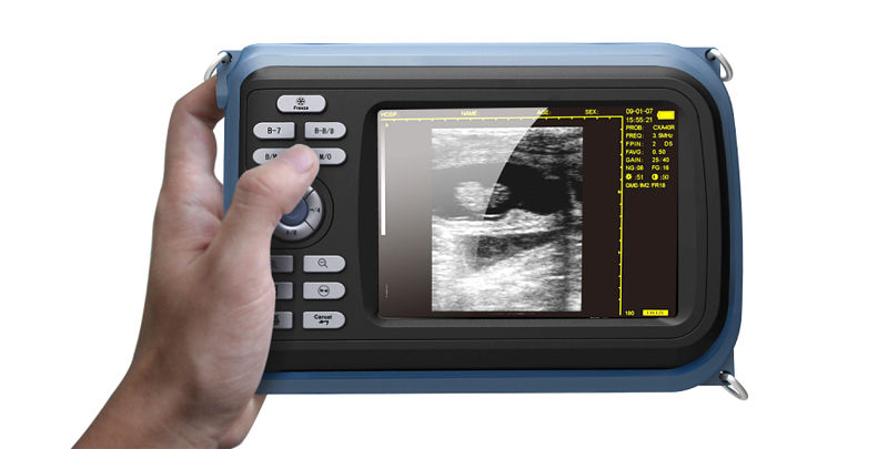Digital Handheld Ultrasound Scanner Ultrasound Machine Micro-Convex Probe A+ DIAGNOSTIC ULTRASOUND MACHINES FOR SALE
