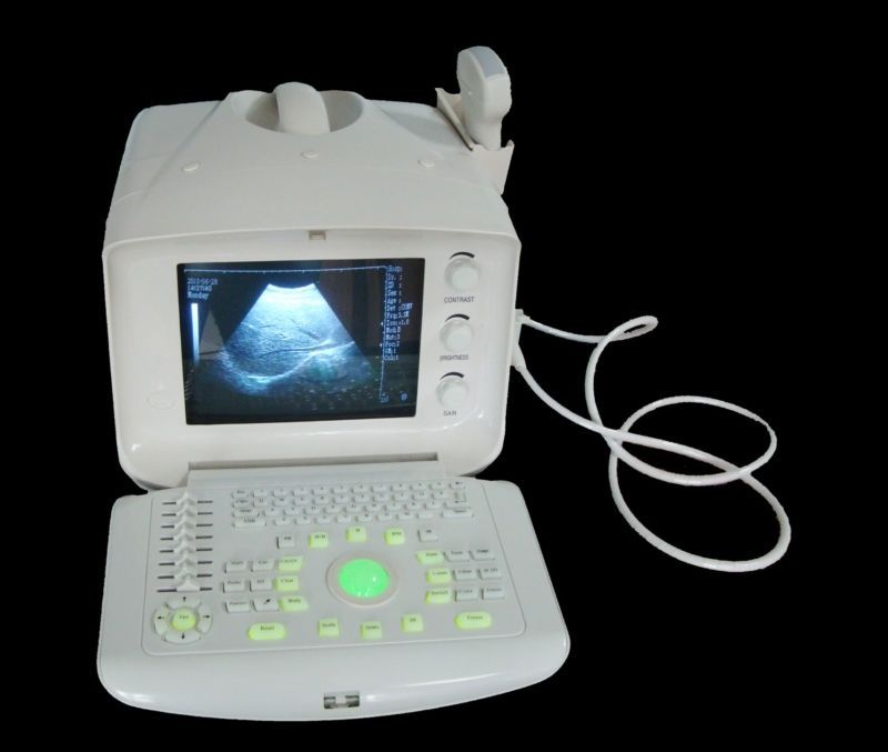 Digital Ultrasound Scanner B Ultrasound machine Convex +Linear 2 Probes 3D Sale DIAGNOSTIC ULTRASOUND MACHINES FOR SALE