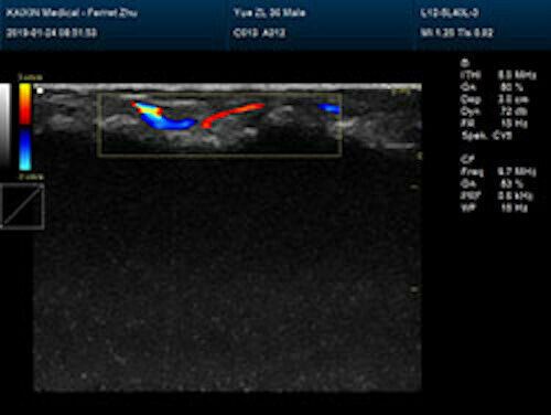 Affordable Large Animal Veterinary Color Doppler Ultrasound & Rectal Probe DIAGNOSTIC ULTRASOUND MACHINES FOR SALE