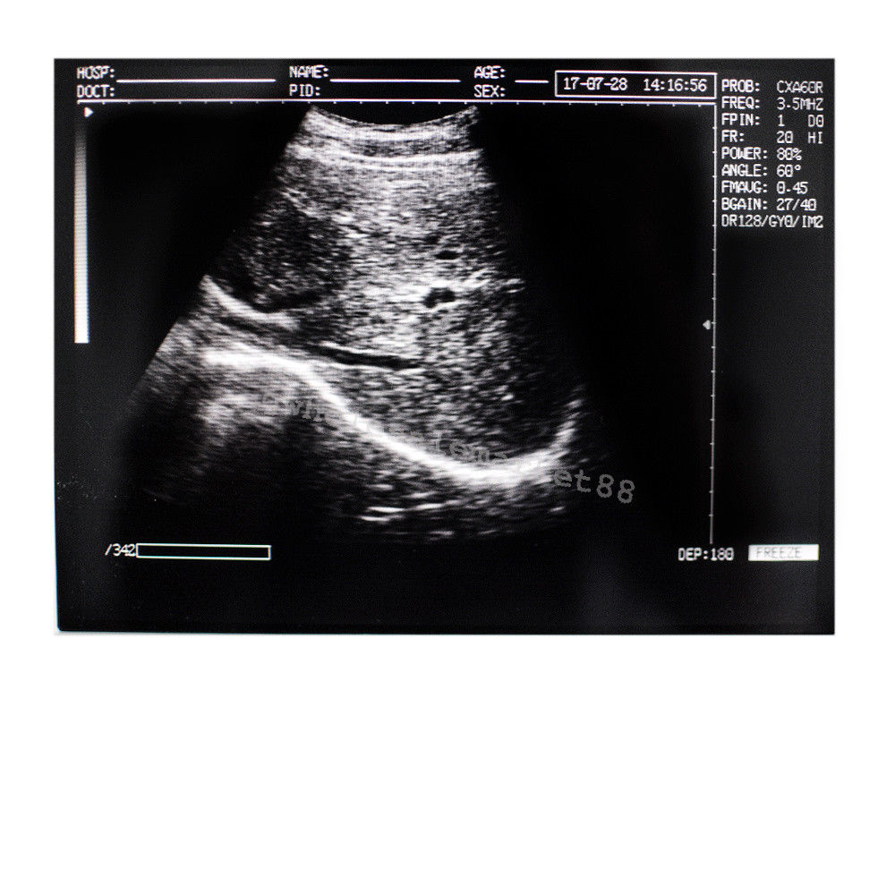 Laptop Ultrasound Machine Scanner Convex Probe 3D Software Clear Medical Clinic 190891045898 DIAGNOSTIC ULTRASOUND MACHINES FOR SALE