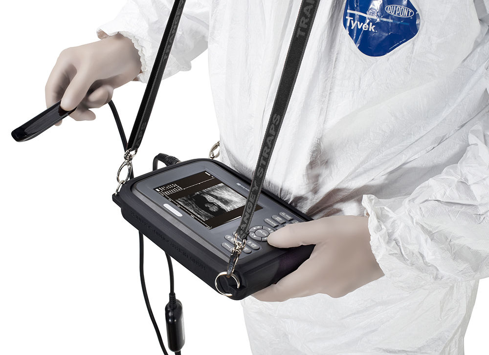 Digital LCD Smartscan Machine Ultrasound Scanner & Micro-convex Probe & Battery 190891411631 DIAGNOSTIC ULTRASOUND MACHINES FOR SALE