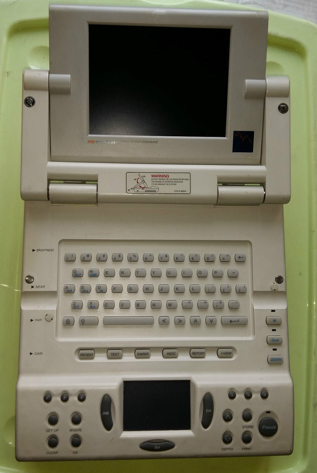 Samsung / Medison mysono 20  Personal digital ultrasound  / Parts DIAGNOSTIC ULTRASOUND MACHINES FOR SALE