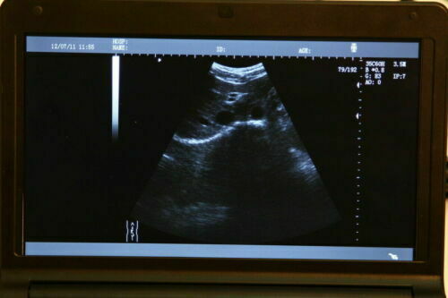 Digital Laptop Ultrasound Scanner with Transvaginal Micro Convex 2 Probes Fast DIAGNOSTIC ULTRASOUND MACHINES FOR SALE